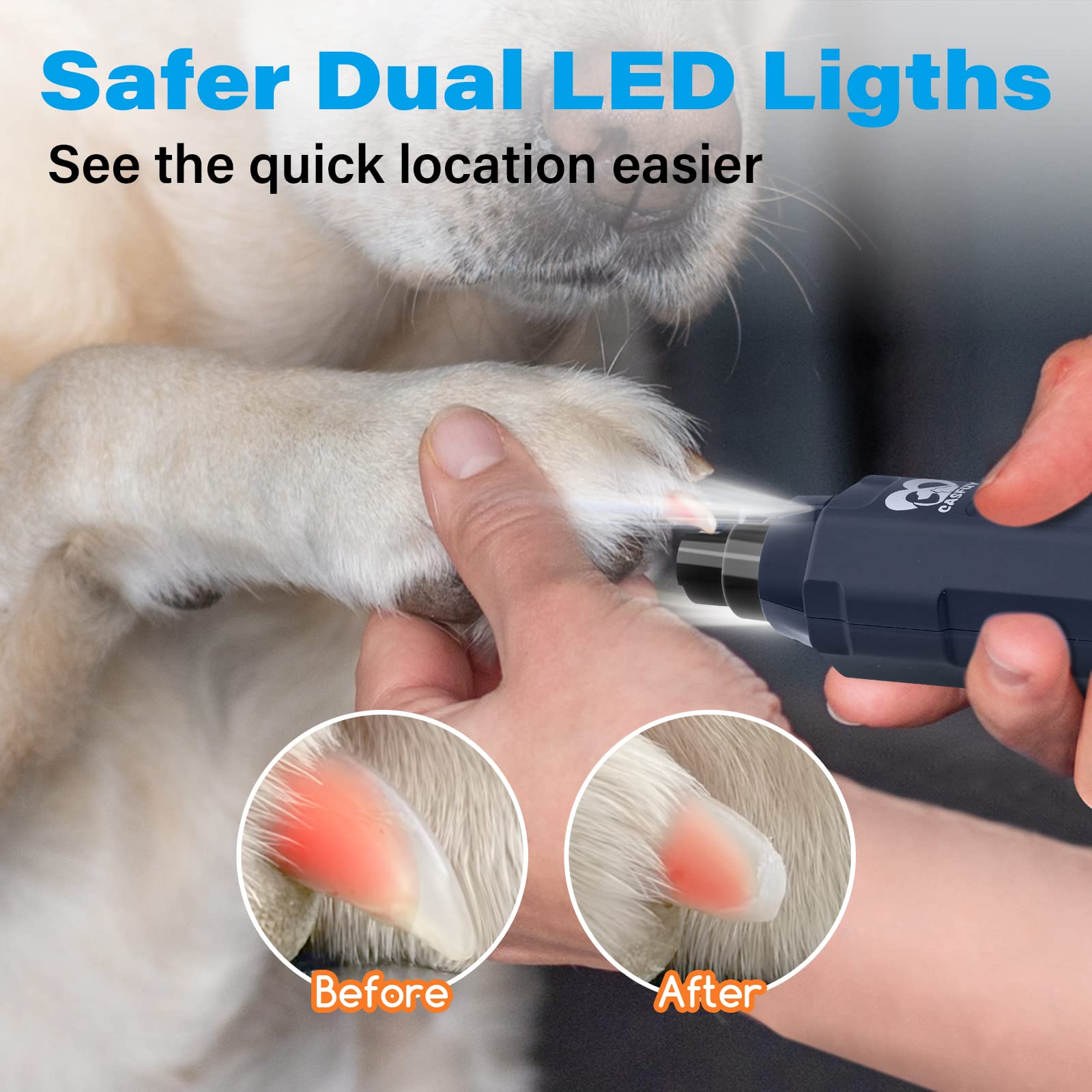 Casfuy dual LED lights close-up for precise nail grinding.