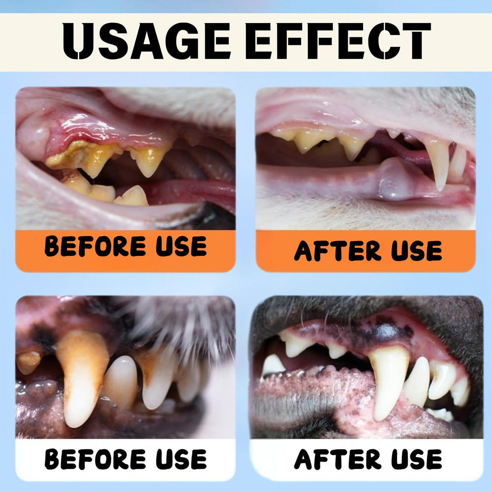 Generic Dental Plus targets tartar buildup for healthier teeth