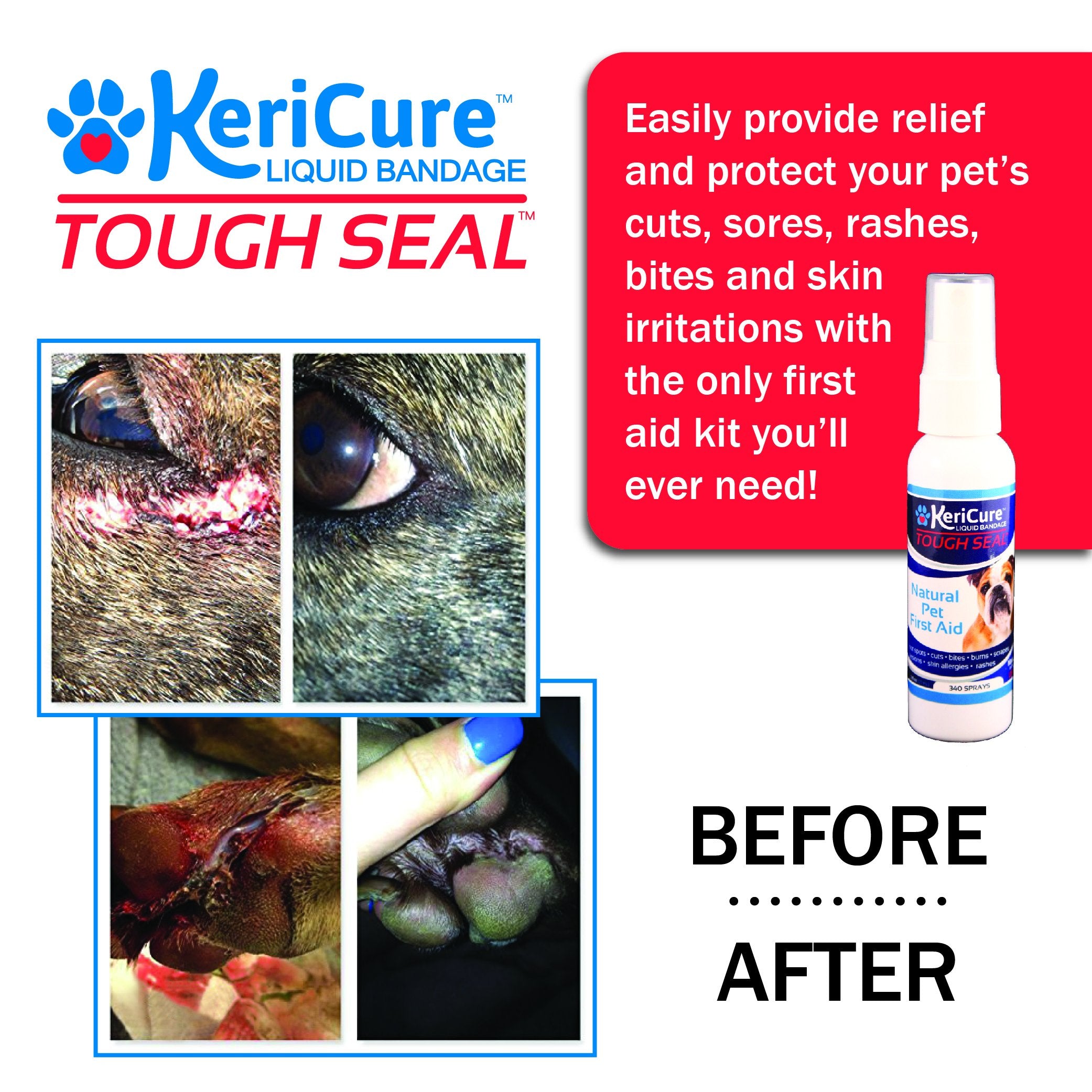 Tough Seal forms a waterproof, breathable barrier over a sore.