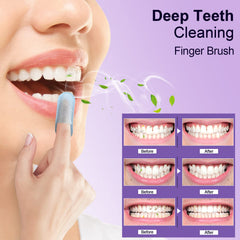 MySmile disposable finger brush wipes for travel convenience.