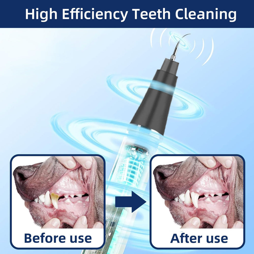Psytpusa dental stain eliminator for quick surface stain reduction