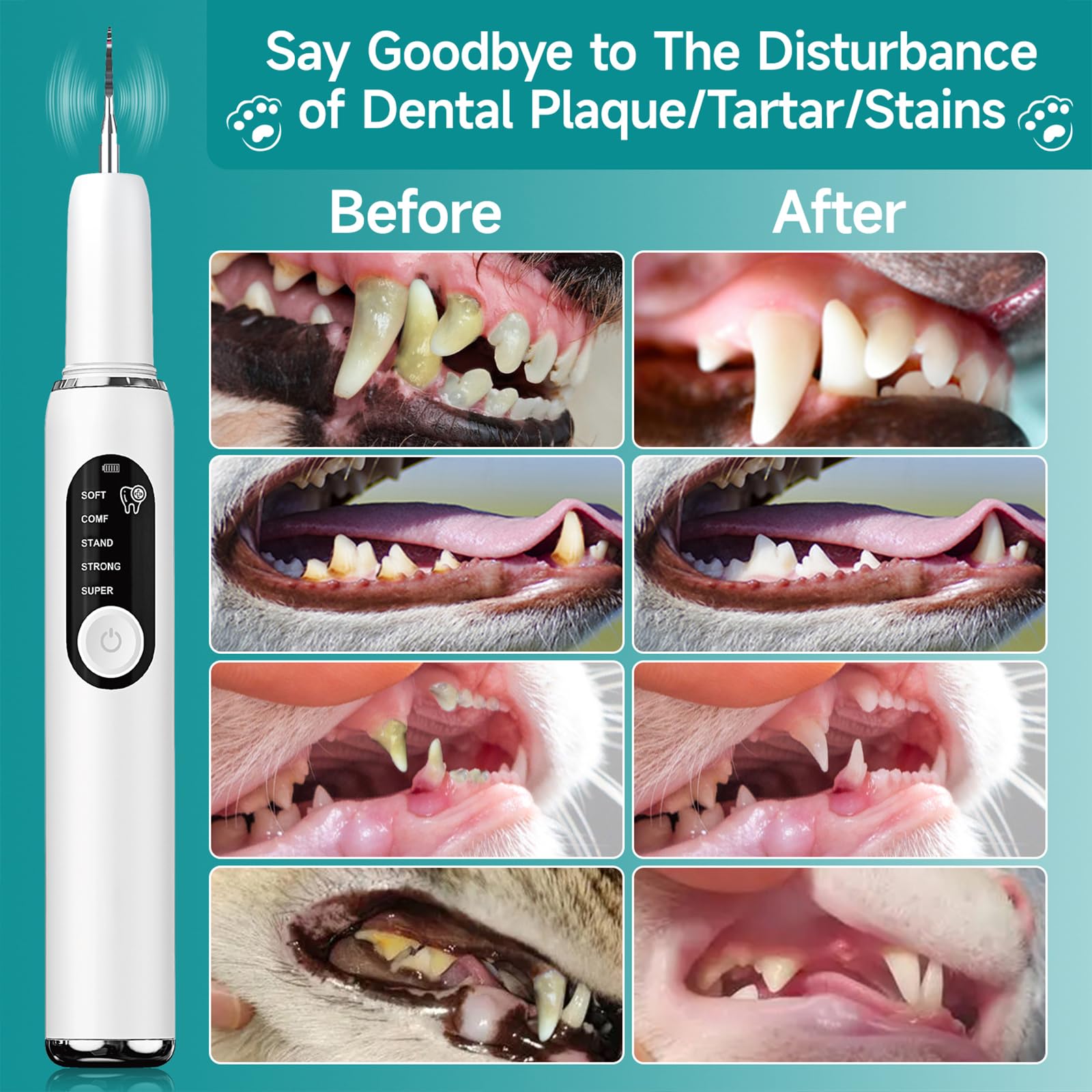 QVKHPCL smart safety features protect gums during home cleaning sessions