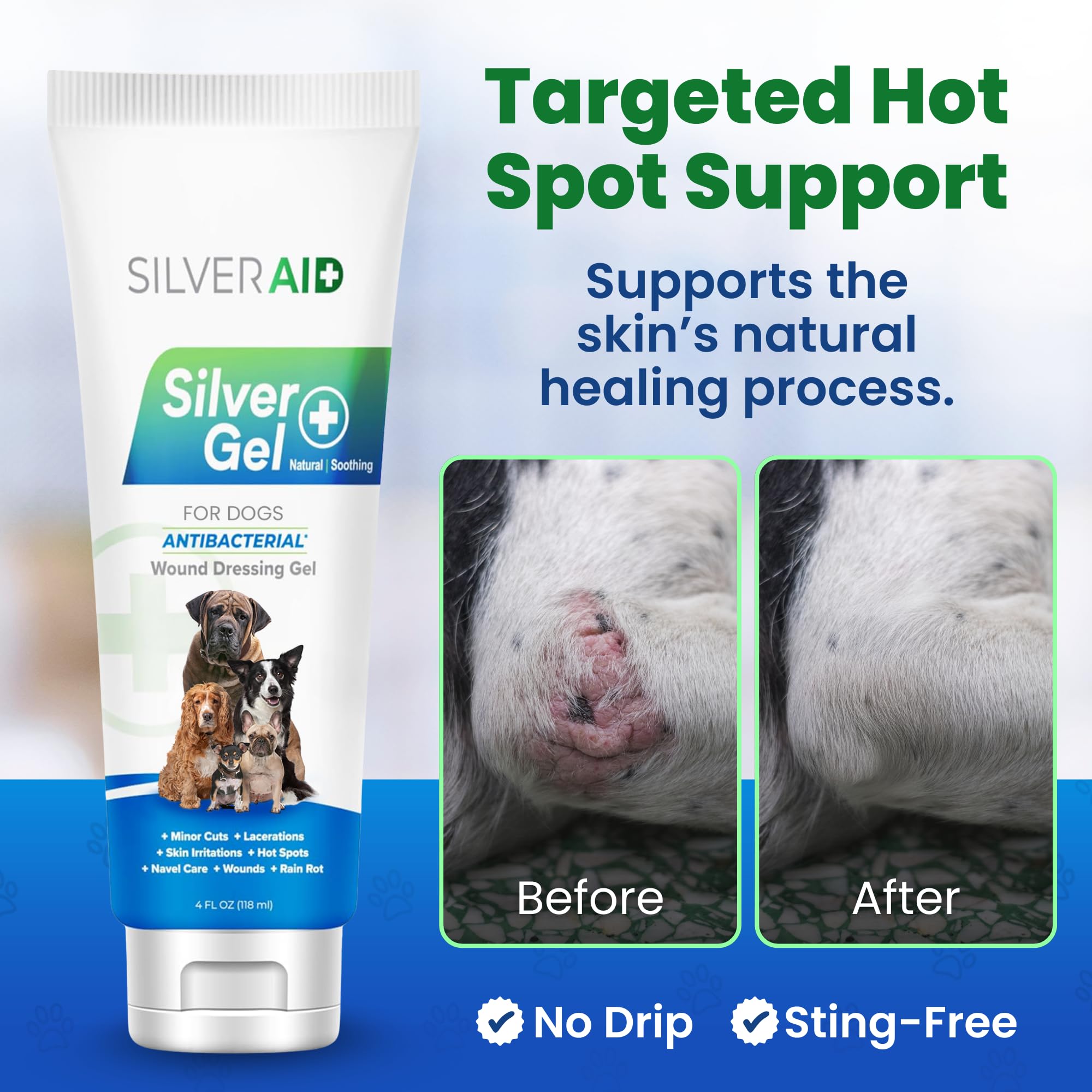 SilverAid nano silver technology helps maintain cleanliness around affected areas