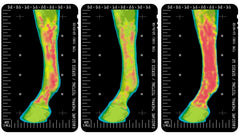 Thermaflex lineament aiding temporary soreness and swelling after activity